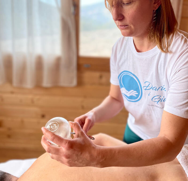 Terapia con ventosas en Badalona